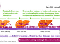 Eighty percent with advanced liver disease in SW are undiagnosed